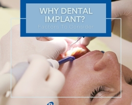 Trồng răng giả với công nghệ Implant Platon Japan