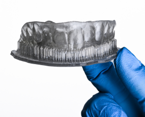 Nha khoa xâm lấn tối thiểu và quy trình kỹ thuật số - Flowable Injection Technique - FIT